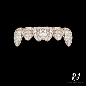 Custom Diamond grillz in 10K yellow Gold